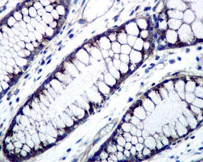 IHC of paraffin-embedded human colon tissue using anti-GOLPH2 antibody.
