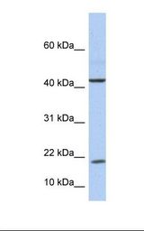 Fetal liver lysate. Antibody concentration: 1.0 ug/ml. Gel concentration: 10-20%.