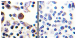 IHC of paraffin-embedded human lymph node, using IL-9R (Ab-519) Antibody. The picture on the right is treated with the synthesized peptide.