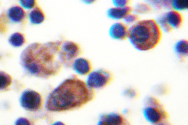 IHC of IL-9R (L514) pAb in paraffin-embedded human lymph node tissue.