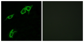 Immunofluorescence of LOVO cells, using GPR75 Antibody. The picture on the right is treated with the synthesized peptide.