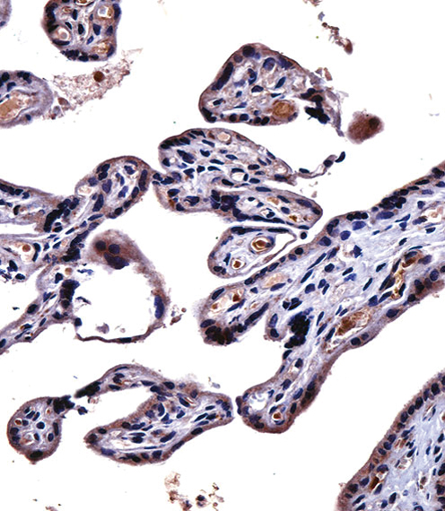 IL9R Antibody immunohistochemistry of formalin-fixed and paraffin-embedded human placenta tissue followed by peroxidase-conjugated secondary antibody and DAB staining.