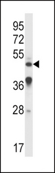 IL9R Antibody western blot of A549 cell line lysates (35 ug/lane). The IL9R antibody detected the IL9R protein (arrow).