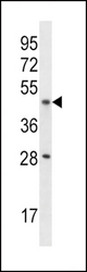IL9R Antibody western blot of mouse liver tissue lysates (35 ug/lane). The IL9R antibody detected the IL9R protein (arrow).