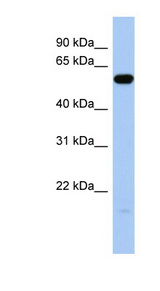 ILDR1 antibody LS-C111697 Western blot of Fetal Brain lysate.