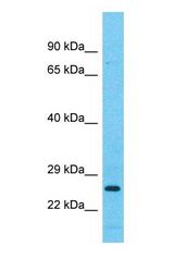 Western blot of FAM3C Antibody with human 786-0 Whole Cell lysate.