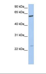 721_B cell lysate. Antibody concentration: 1.0 ug/ml. Gel concentration: 12%.