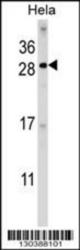 FAM3C Antibody (C-term) Western blot analysis in Hela cell line lysates (35 ug/lane). This demonstrates the FAM3C antibody detected the FAM3C protein (arrow).