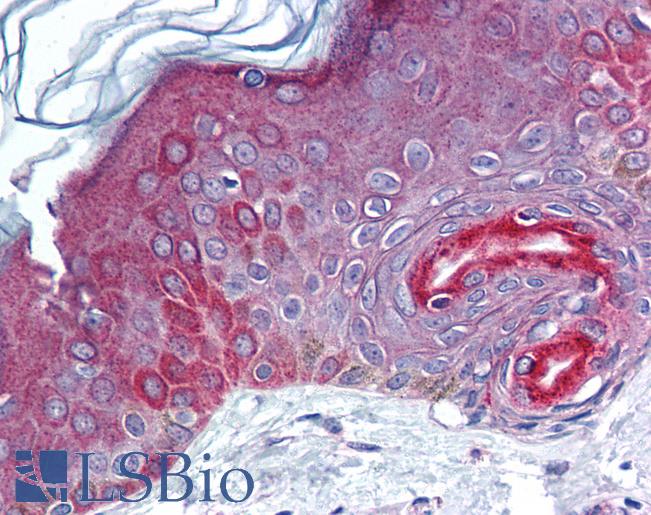 Anti-FAM3C antibody IHC of human skin. Immunohistochemistry of formalin-fixed, paraffin-embedded tissue after heat-induced antigen retrieval. Antibody LS-B1791 concentration 10 ug/ml.
