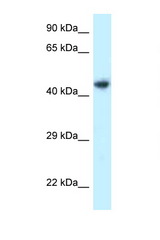 ILKAP antibody LS-C145783 Western blot of 721_B Cell lysate. Antibody concentration 1 ug/ml.