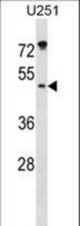 ILKAP Antibody western blot of U251 cell line lysates (35 ug/lane). The ILKAP antibody detected the ILKAP protein (arrow).