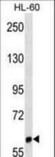 LILRB1 Antibody western blot of HL-60 cell line lysates (35 ug/lane). The LILRB1 antibody detected the LILRB1 protein (arrow).