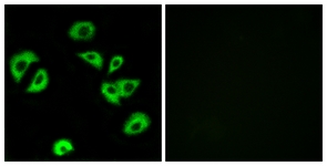 Immunofluorescence of A549 cells, using LILRB4 Antibody. The picture on the right is treated with the synthesized peptide.
