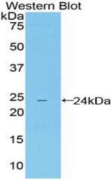 Western blot of recombinant ILT3 / LILRB4.