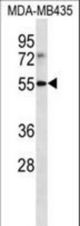 LILRB4 Antibody western blot of MDA-MB435 cell line lysates (35 ug/lane). The LILRB4 antibody detected the LILRB4 protein (arrow).