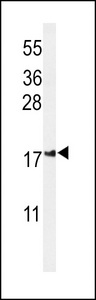 Western blot of IMP2L Antibody in Jurkat cell line lysates (35 ug/lane). IMP2L (arrow) was detected using the purified antibody.