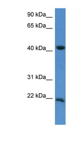 IMMP2L antibody LS-C135821 Western blot of Fetal Lung lysate.