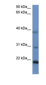 IMMP2L antibody LS-C135820 Western blot of HepG2 cell lysate.