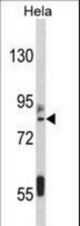 Western blot of IMMT Antibody in HeLa cell line lysates (35 ug/lane). IMMT (arrow) was detected using the purified antibody.