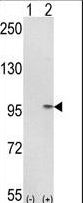 Western blot of IMMT (arrow) using rabbit polyclonal IMMT Antibody. 293 cell lysates (2 ug/lane) either nontransfected (Lane 1) or transiently transfected with the IMMT gene (Lane 2).