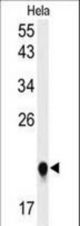 Western blot of IMP3 Antibody in HeLa cell line lysates (35 ug/lane). IMP3 (arrow) was detected using the purified antibody.