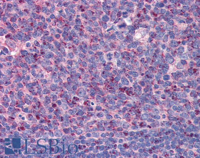 Anti-IMP3 antibody IHC of human tonsil. Immunohistochemistry of formalin-fixed, paraffin-embedded tissue after heat-induced antigen retrieval. Antibody LS-B5716 concentration 5 ug/ml.