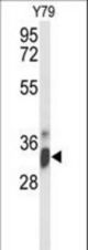 Western blot of IMP4 Antibody in Y79 cell line lysates (35 ug/lane). IMP4 (arrow) was detected using the purified antibody.