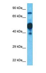 Western blot of SPPL2C Antibody with human Ovary Tumor lysate.