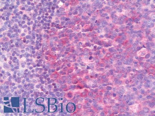 Anti-IMPDH1 antibody IHC staining of human tonsil. Immunohistochemistry of formalin-fixed, paraffin-embedded tissue after heat-induced antigen retrieval. Antibody LS-B11005 dilution 1:100.
