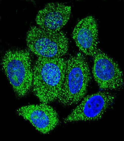 Confocal immunofluorescent of IMPDH1 Antibody with HeLa cell followed by Alexa Fluor 488-conjugated goat anti-rabbit lgG (green). DAPI was used to stain the cell nuclear (blue).
