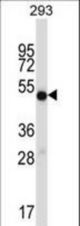 IMPDH1 Antibody western blot of 293 cell line lysates (35 ug/lane). The IMPDH1 antibody detected the IMPDH1 protein (arrow).