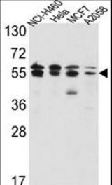 Western blot of IMPDH2 Antibody in NCI-H460,HeLa,MCF7,A2058 cell line lysates(35 ug/lane). IMPDH2 (arrow) was detected using the purified antibody.