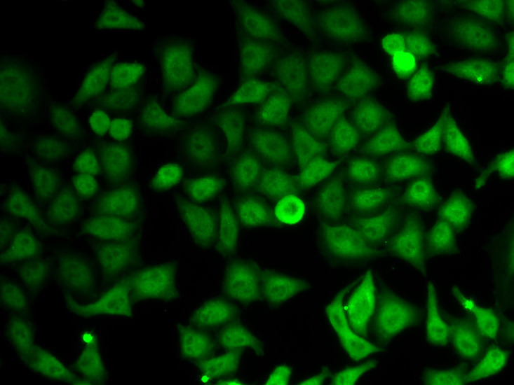 Immunofluorescence analysis of HeLa cell using IMPDH2 antibody.