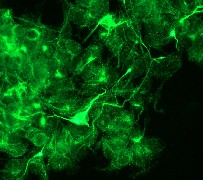 Immunofluorescent staining of PC 12 cells using antibody LS-B6283.