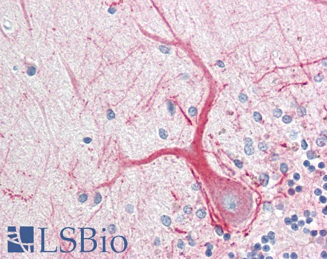 Anti-INA / Alpha Internexin antibody IHC staining of human brain, cerebellum. Immunohistochemistry of formalin-fixed, paraffin-embedded tissue after heat-induced antigen retrieval. Antibody LS-B10413 dilution 1:100.