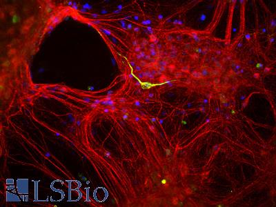 Mixed neuron-glial cultures stained with rabbit antibody to alpha-internexin (red) and chicken antibody to peripherin (green). The alpha internexin antibody stains numerous axonal and dendritic profiles in these cultures, while peripherin antibody binds to only a subset of neurons.