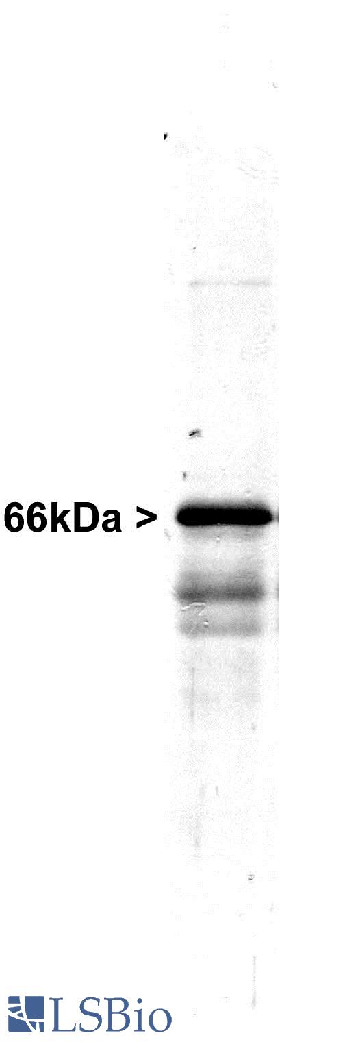 Western blot of whole rat spinal cord homogenate stained with INA / Alpha Internexin antibody, at dilution of 1:20,000. A prominent band running at ~66kDa is apparent, as well as smaller lower bands which are apparently degradation products. A minor band at ~150kDa is also seen, apparently resulting from dimerization of alpha-internexin.