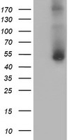 HEK293T cells were transfected with the pCMV6-ENTRY control (Left lane) or pCMV6-ENTRY GOLM1 (Right lane) cDNA for 48 hrs and lysed. Equivalent amounts of cell lysates (5 ug per lane) were separated by SDS-PAGE and immunoblotted with anti-GOLM1.