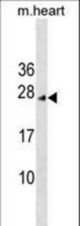 INCA1 Antibody western blot of mouse heart tissue lysates (35 ug/lane). The INCA1 antibody detected the INCA1 protein (arrow).