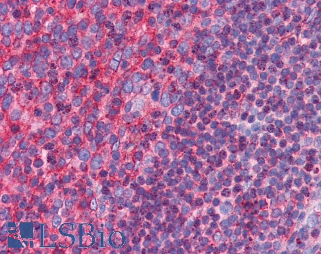 Anti-C3orf54 antibody IHC of human tonsil. Immunohistochemistry of formalin-fixed, paraffin-embedded tissue after heat-induced antigen retrieval. Antibody LS-B5062 concentration 5 ug/ml.