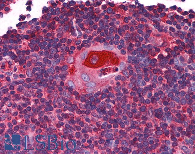 Anti-C3orf54 antibody IHC of human thymus. Immunohistochemistry of formalin-fixed, paraffin-embedded tissue after heat-induced antigen retrieval. Antibody LS-B5062 concentration 5 ug/ml.