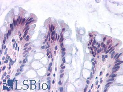 Anti-GPR82 antibody LS-A2706 IHC of human colon. Immunohistochemistry of formalin-fixed, paraffin-embedded tissue after heat-induced antigen retrieval.