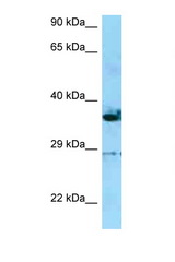INF2 antibody LS-C146490 Western blot of HepG2 Cell lysate. Antibody concentration 1 ug/ml.