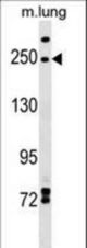 INF2 Antibody western blot of mouse lung tissue lysates (35 ug/lane). The INF2 antibody detected the INF2 protein (arrow).