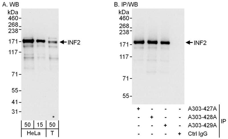 Detection of Human INF2 by Western Blot and Immunoprecipitation. Samples : Whole cell lysate from HeLa (15 and 50 ug for WB; 1 mg for IP, 20% of IP loaded) and 293T (T; 50 ug) cells. Antibodies: Affinity purified rabbit anti-INF2 antibody A303-42 9A used for WB at 0.04 ug/ml (A) and 0.4 ug/ml (B) and used for IP at 6 ug/mg lysate. INF2 was also immunoprecipitated by rabbit anti-INF2 antibodies A303-427 A and A303-42 8 A, which recognize other epitopes. Detection: Chemiluminescence with exposure times of 30 seconds (A) and 3 seconds (B).