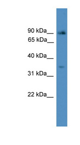 ING2 antibody LS-C117057 Western blot of COLO205 cell lysate.
