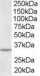 Antibody staining (2 ug/ml) of HepG2 lysate (RIPA buffer, 35 ug total protein per lane). Primary incubated for 12 hour. Detected by Western blot of chemiluminescence.
