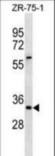 ING2 Antibody western blot of ZR-75-1 cell line lysates (35 ug/lane). The ING2 antibody detected the ING2 protein (arrow).