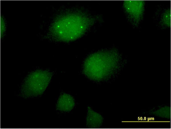 Immunofluorescence of monoclonal antibody to ING2 on HeLa cell . [antibody concentration 10 ug/ml]