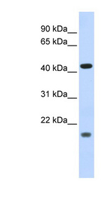ING3 antibody LS-B6681 Western blot of Fetal Heart lysate.